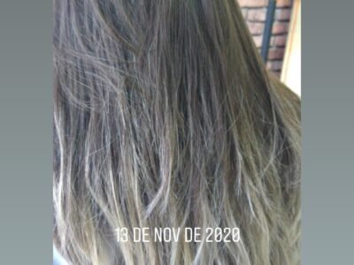 Terapia Capilar